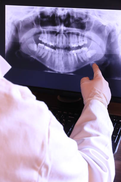 Best Emergency Wisdom Teeth Removal in Anaconda, MT