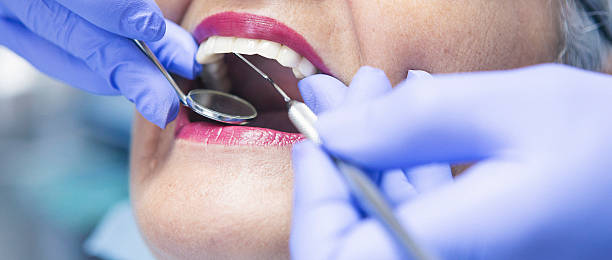 Best Emergency Root Canal Treatment in Anaconda, MT